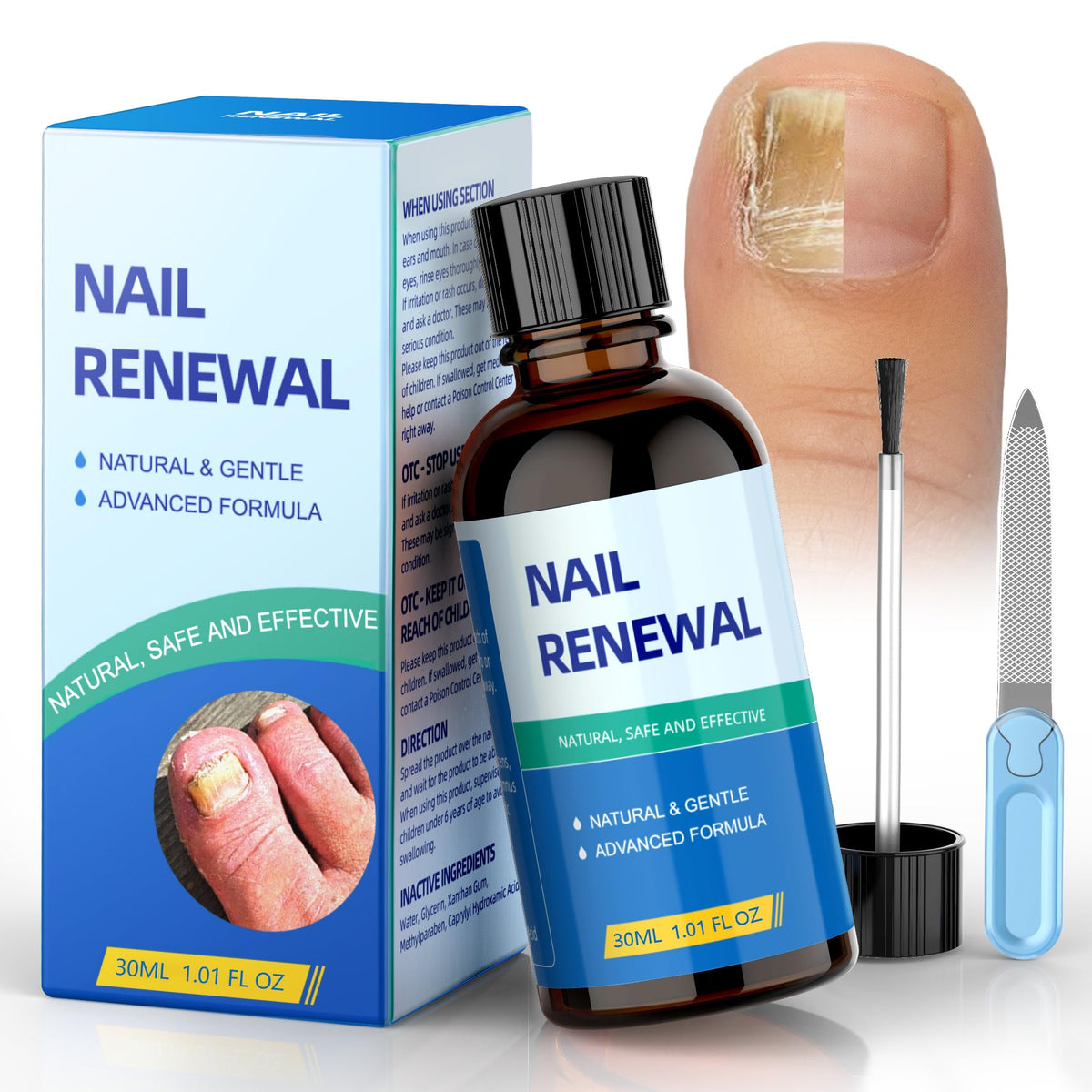 5X Powerful Toenail Fungus Treatment Extra Strength with Acetic Acid Effective Fungus Nail Treatment for Toenail & Fingernail Nail Repairs for Damaged Discolored Nails & Athletes Foot（1.01oz）