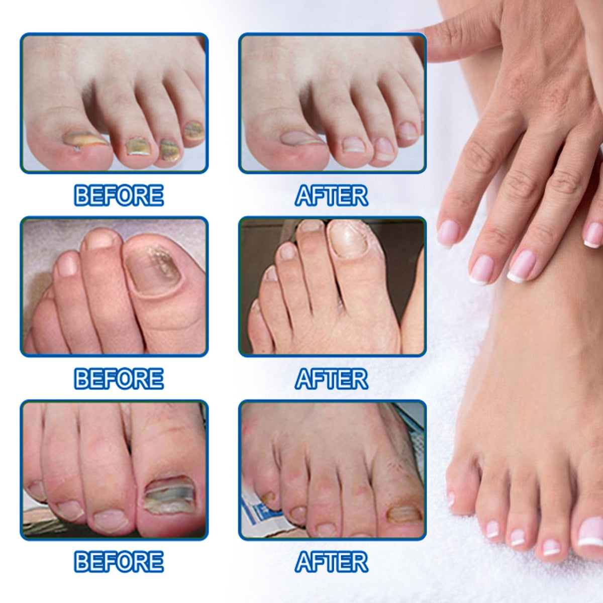 Nail Repair Bandage