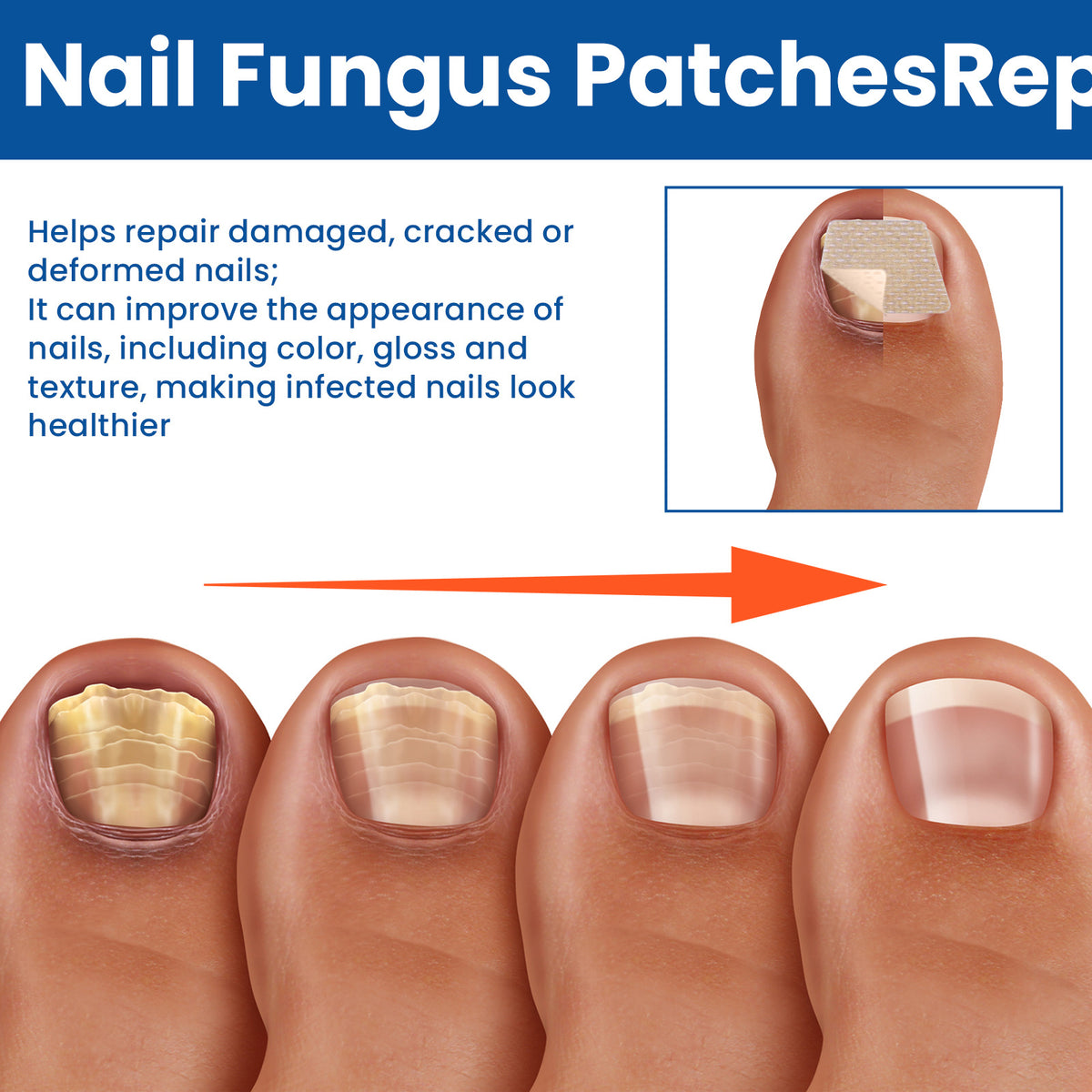 Nail Repair Bandage
